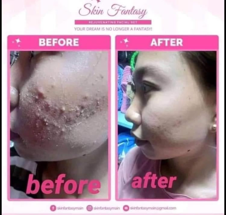 Beauty Love Skin Essentials Rejuvenating Set – Basbox Beauty