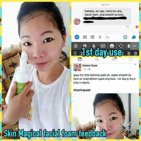 Skin Magical Purifying and Acne Clearing Facial Foaming Wash