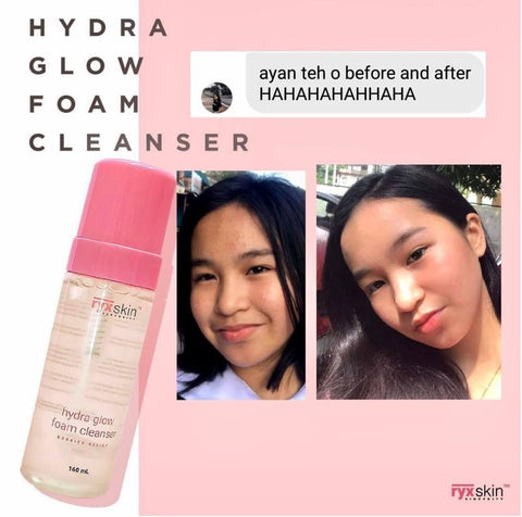 RyxSkin Hydra Glow Facial Foam Cleanser 160ml