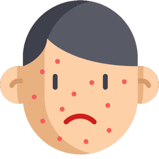 Skin Care Products for Acne / Pimple