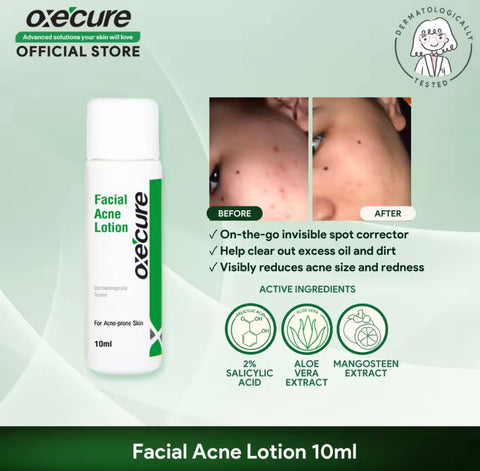 Oxecure - Facial Acne Lotion 10 ML