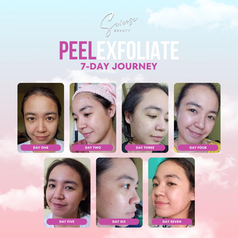 Sereese Beauty - Peel Exfoliating Set