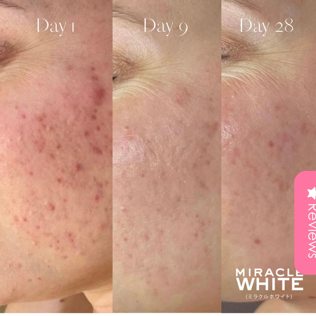 miracle white glutathione reviews Beauty Glow, 30 Capsules Miracle White Glutathione + Collagen