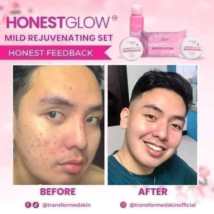 Transformed Skin - Honest Glow Facial Set