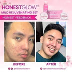 Transformed Skin - Honest Glow Facial Set