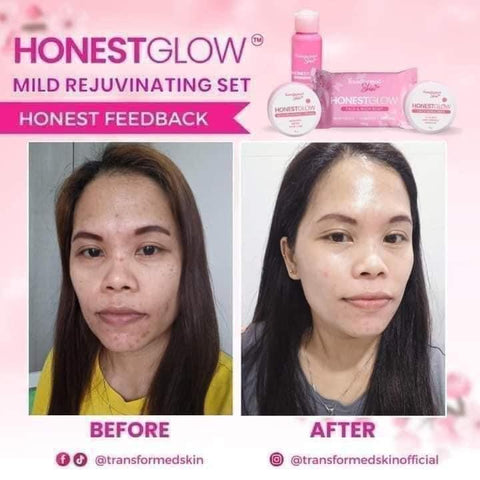 Transformed Skin - Honest Glow Facial Set