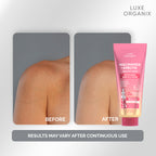 Luxe Organix - NIACINAMIDE + ALPHA ARBUTIN WHITENING SERUM LOTION 350ML ( PINK )