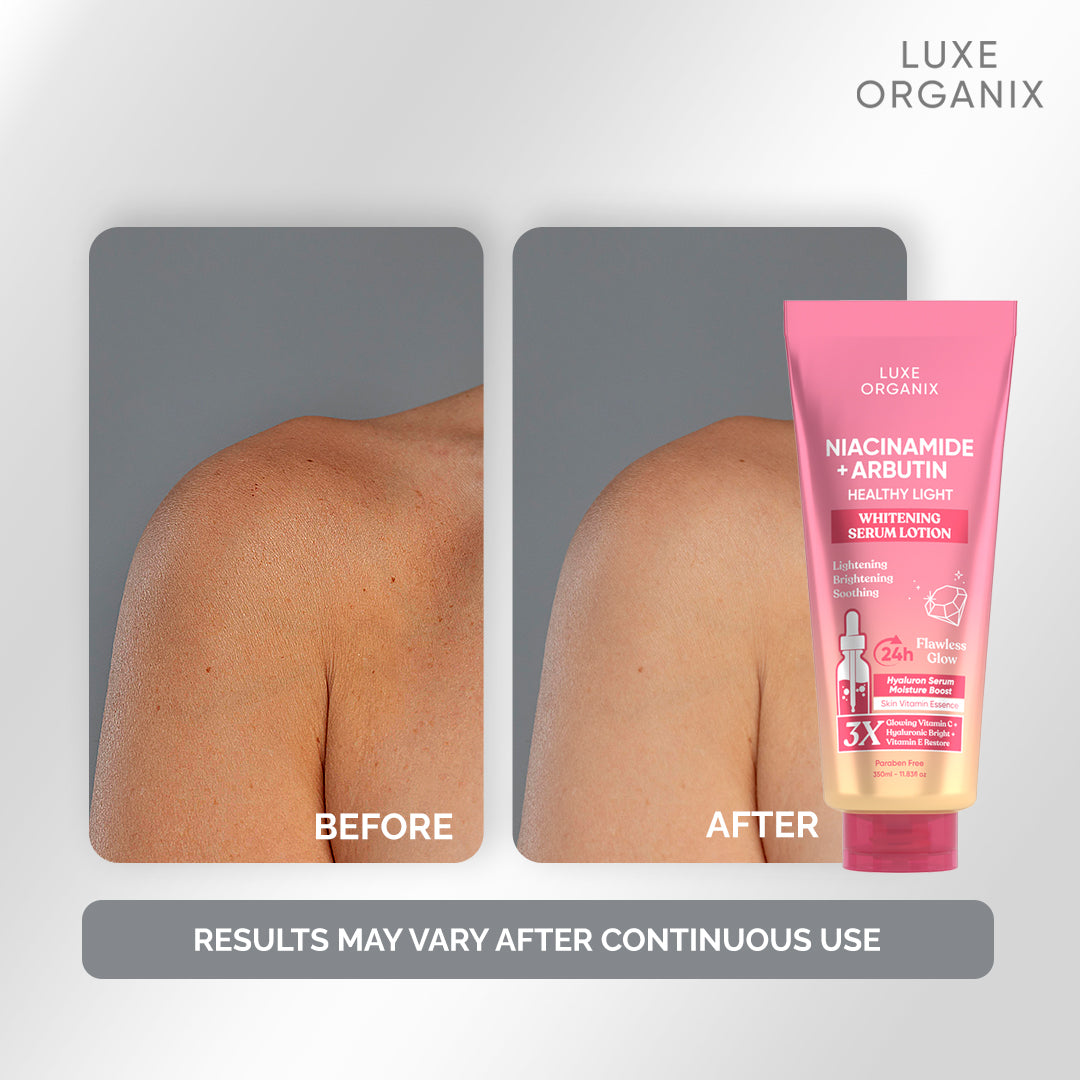 Luxe Organix - NIACINAMIDE + ALPHA ARBUTIN WHITENING SERUM LOTION 350ML ( PINK )