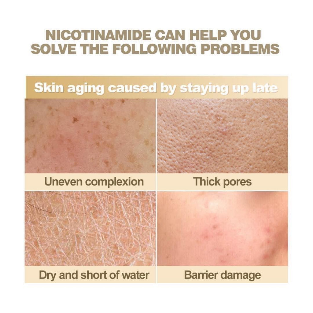 ASHLEY - NIACINAMIDE PURE SERUM 520 ML