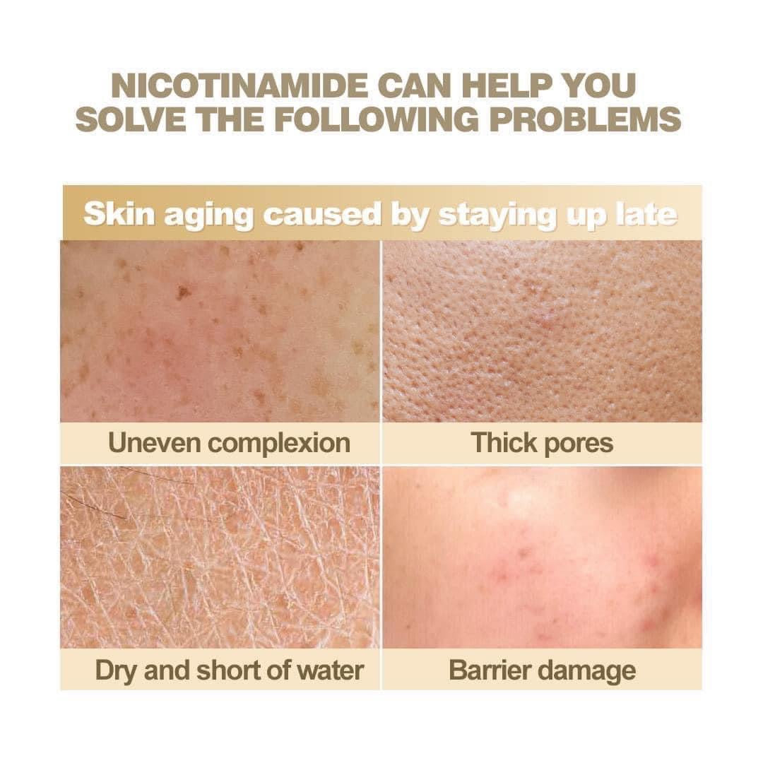 ASHLEY - NIACINAMIDE PURE SERUM 520 ML