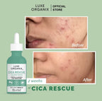 Luxe Organix - Cica Rescue Calming Serum 30 ML