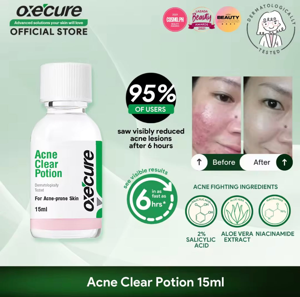 Oxecure - Acne Clear Potion 15 ML