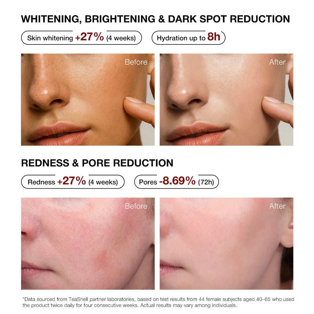 TeaShell Niacinamide Brightening Serum 5% – 30ml