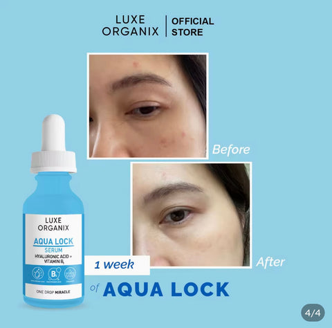 Luxe Organix - AQUA LOCK Hyaglow White serum 30 ml