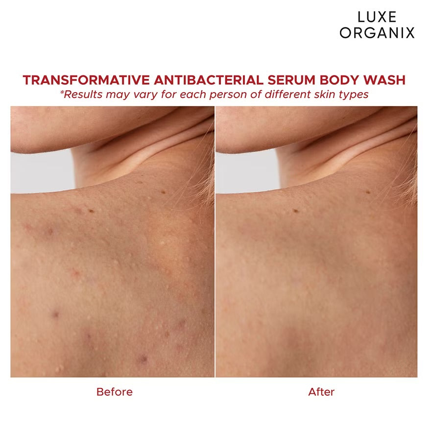Luxe Organix - Salicylic Acid 2% Acne Rescue Serum Antibacterial Body Wash 500ml