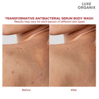Luxe Organix - Salicylic Acid 2% Acne Rescue Serum Antibacterial Body Wash 500ml