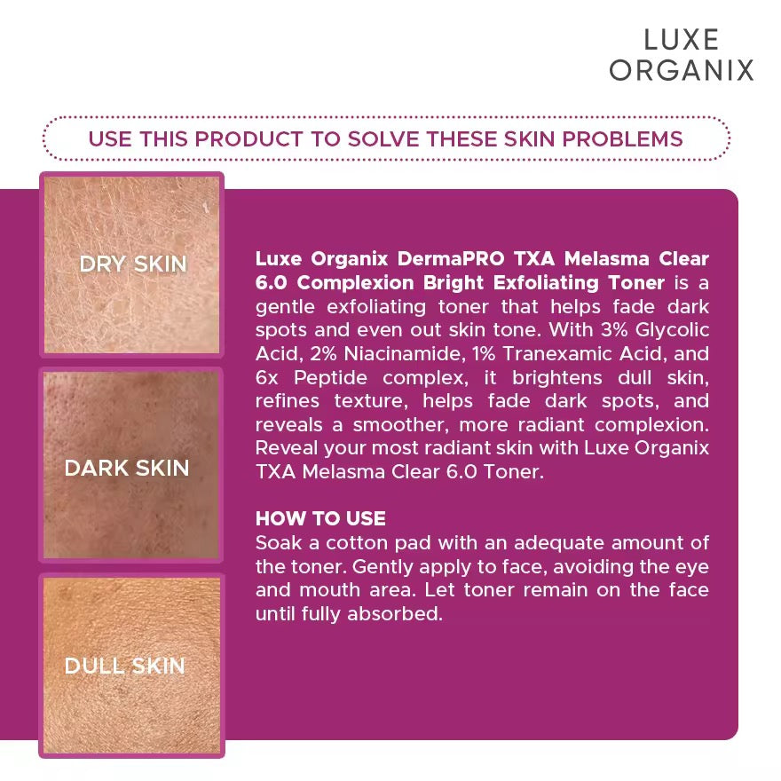 Luxe Organix - TXA Melasma Clear 6.0 Complexion Bright  “EXFOLIATING TONER” - 150ml