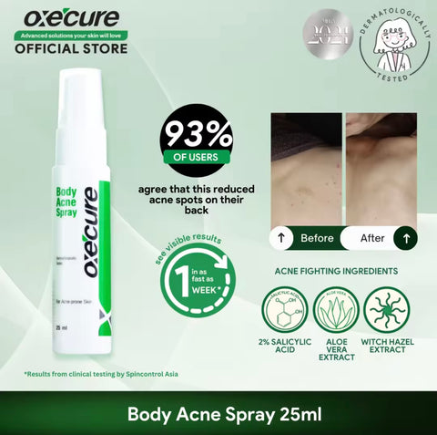 Oxecure - Body Acne Spray 25 ml