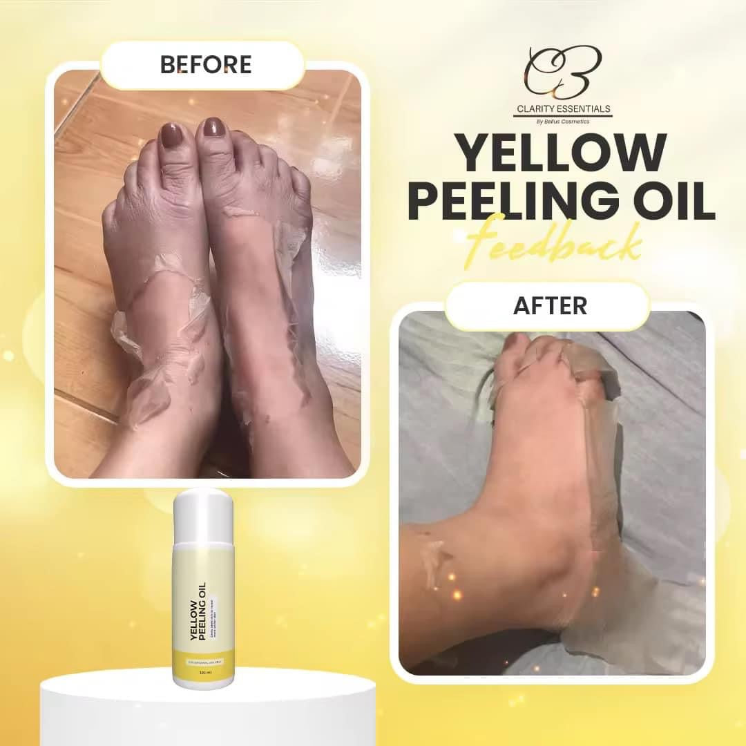 Clarity Essentials - Yellow Peeling Oil 120 ML