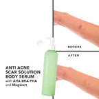Grace and Glow - English Pear and Freesia - “ANTI ACNE & SCAR SOLUTION” Body Serum 300 ml  ( Green )