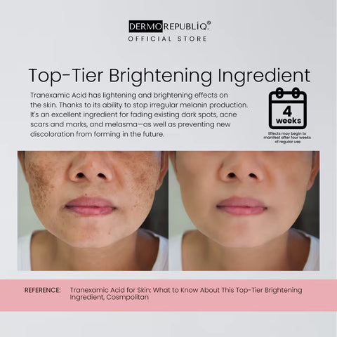 Dermo Republiq Serum 10% Niacinamide + 3% TRANEXAMIC Acid + 2% Alpha Arbutin  30ml (Ultra White Formula)