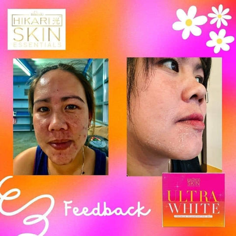 Hikari Skin Essentials - Ultra White Premium Rejuvenating Set