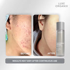 Luxe Organix  - Whitening Repair Ultra Light Glow “TONER” 150ml - ( Gray Bottle )