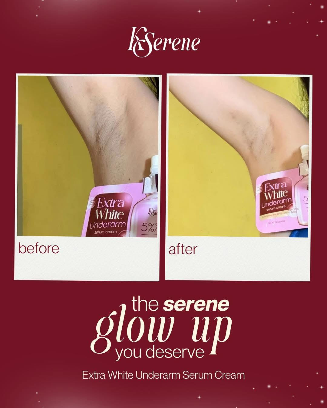 KSerene - Extra White Underarm Cream 30g