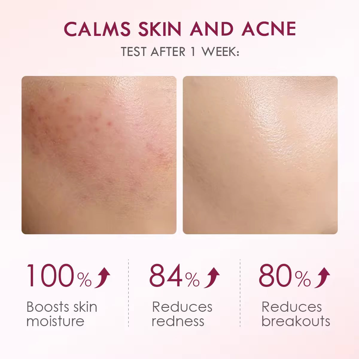 The Originote - Beauty in Unity Hyalucera Moisturizer - Hyaluron + Ceramide with Chlorelina 50ml