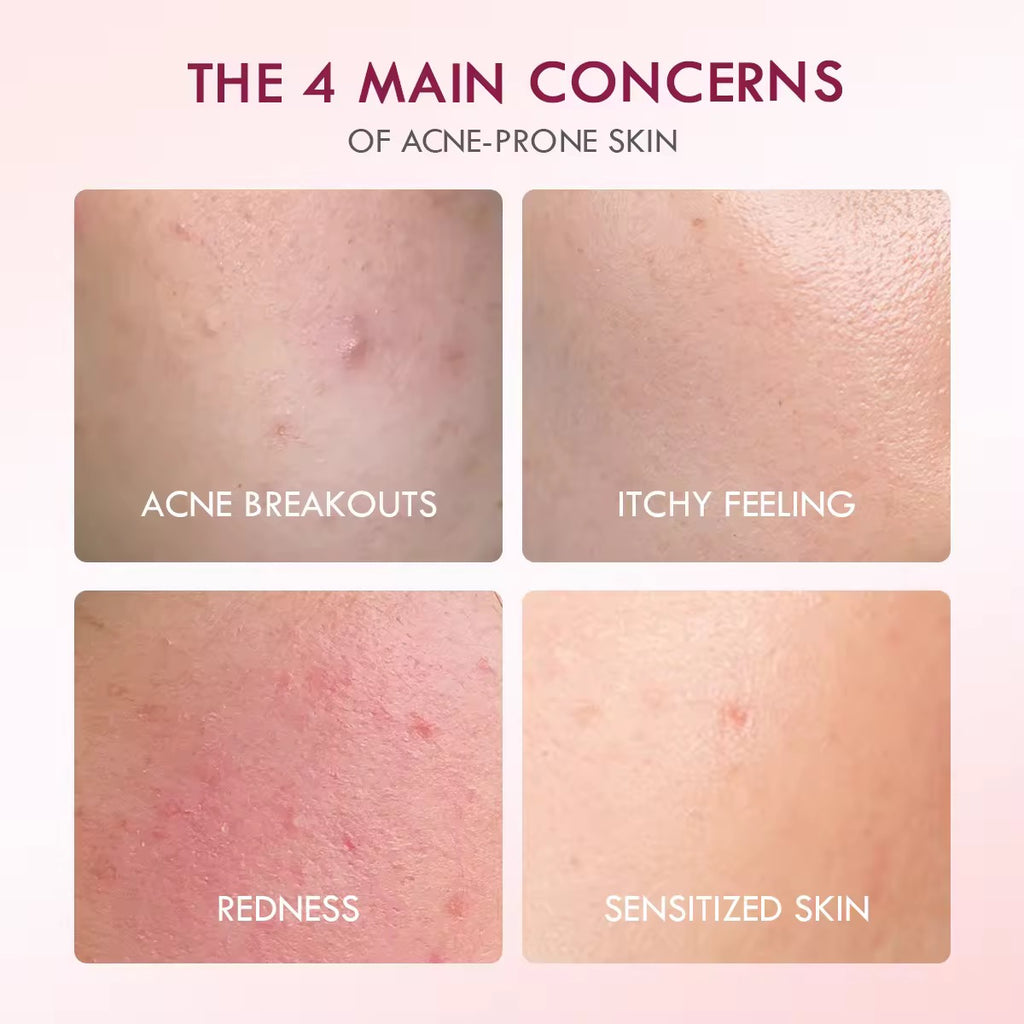 The Originote - Beauty in Unity Hyalucera Moisturizer - Hyaluron + Ceramide with Chlorelina 50ml
