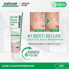 Oxecure - Acne Clear Powder Mud 30g ( Big size )