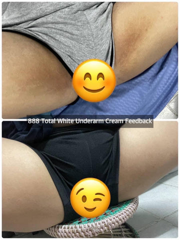 888 Total Whitening Underarm Cream 35g - BLACK
