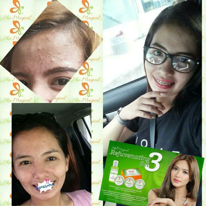 Skin Magical Rejuvenating Set No. 3 - My Care Kits