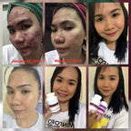 Luxxe White - Enhanced Glutathione 60 Capsules (775mg) - My Care Kits