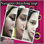 Navarro's Bleaching Soap Instant Permanent White (pink box) - My Care Kits