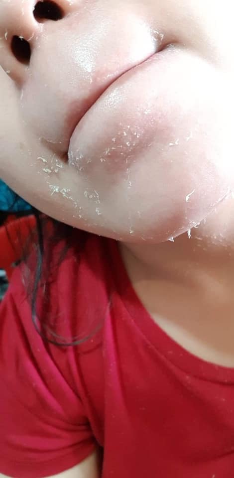 Brilliant Skin Essentials Rejuvenating Facial Set - NEW FORMULA !! - My Care Kits