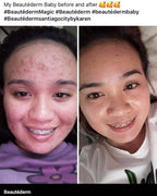 Beautederm Regular Set with upgraded toner 120ml ( large ) - My Care Kits