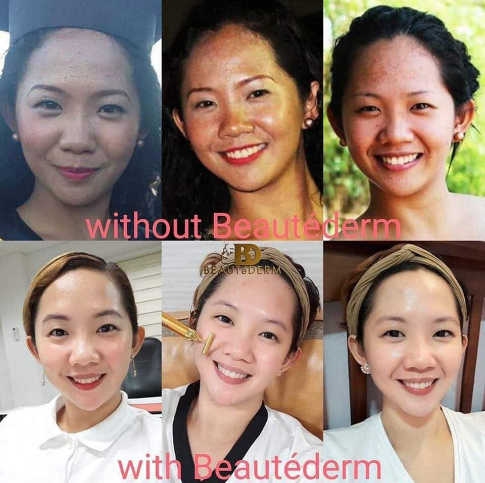 Beautederm Regular Set with upgraded toner 120ml ( large ) - My Care Kits