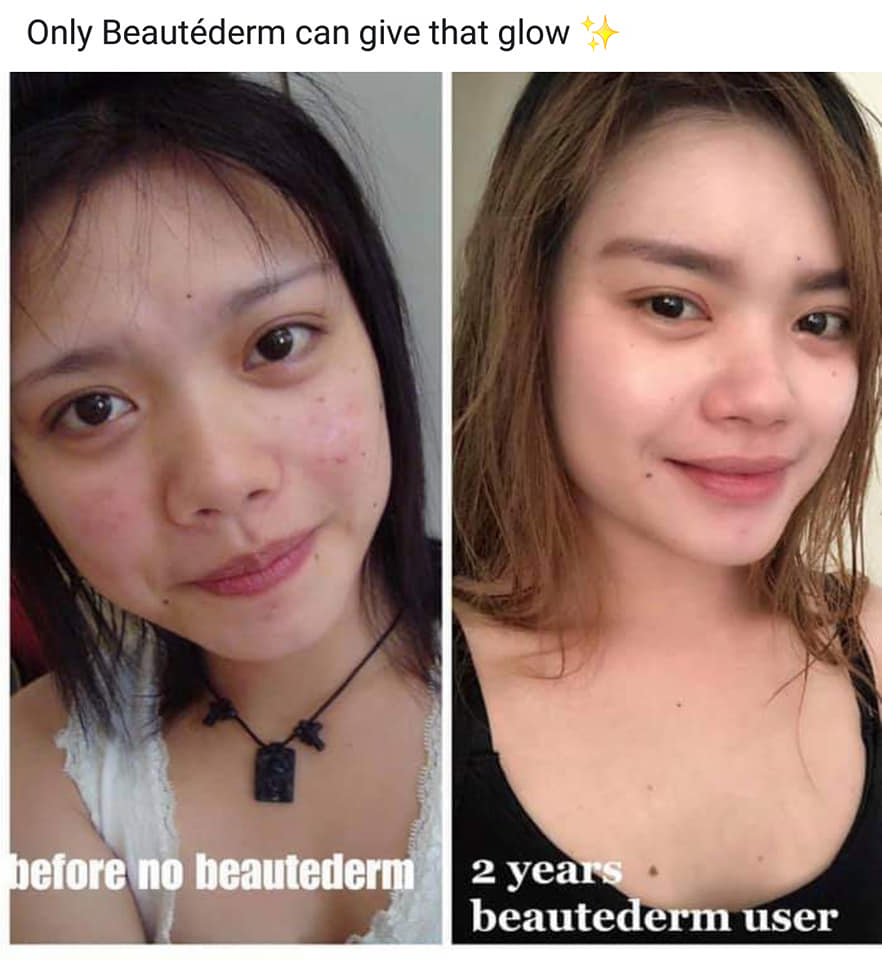 Beautederm Regular Set with upgraded toner 120ml ( large ) - My Care Kits