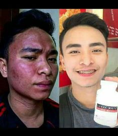 Luxxe White Ultima Glutathione + Collagen 1400 mg 60 Capsules Suppleme My Care Kits Luxxe White Ultima Glutathione + Collagen 1400 mg 60 Capsules Suppleme My Care Kits