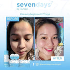 HerSkin SevenDays Facial Set - Seven Days - My Care Kits