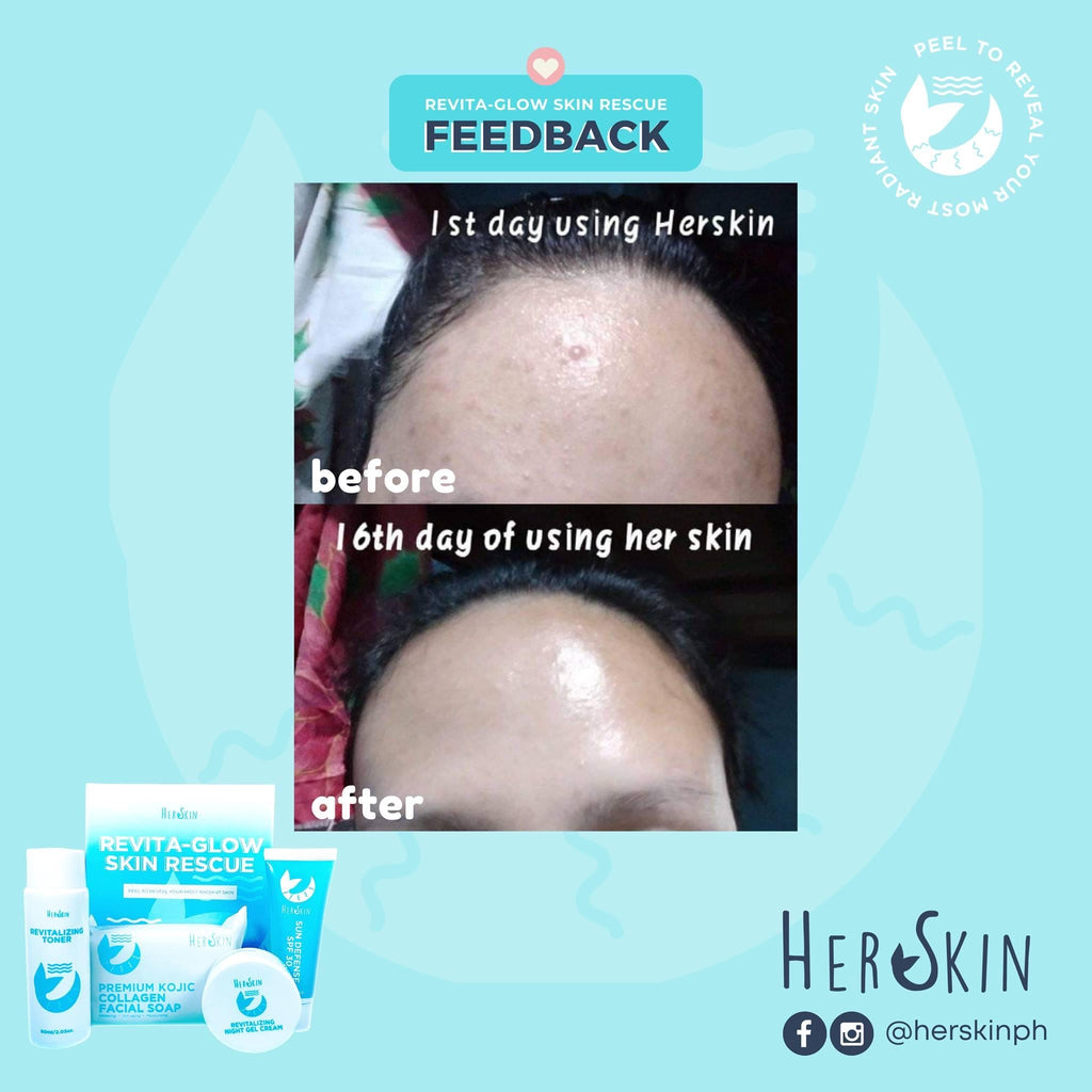 HerSkin Revita-Glow Skin Rescue Set - My Care Kits