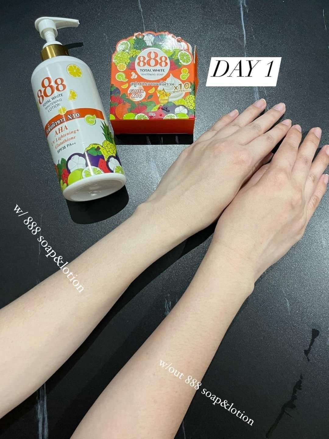 888 Total White Whitening Lotion SPF 35 - My Care Kits