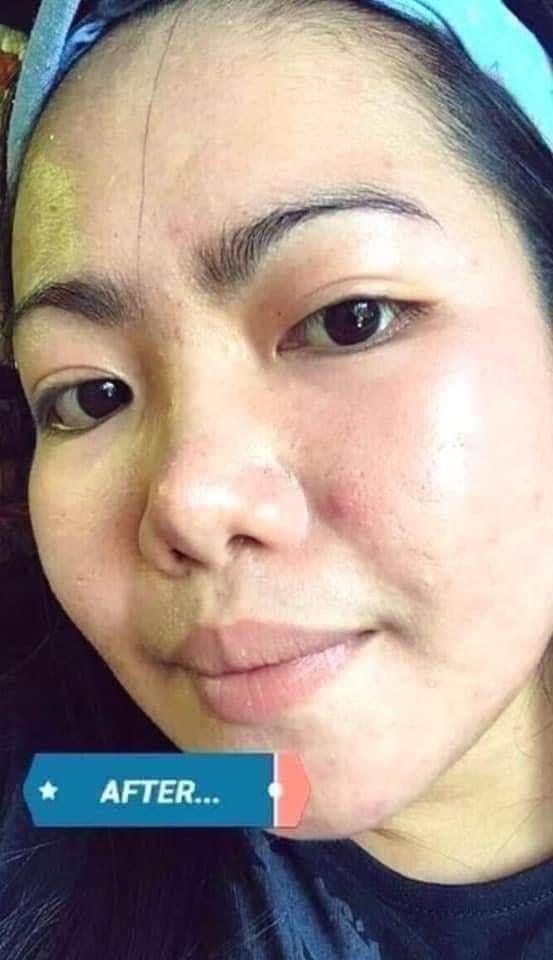 Beauty Vault Premium Rejuvenating set ( NEW PACKAGING ) - My Care Kits