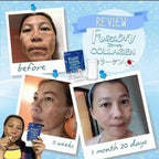 Frozen Collagen 2 in 1 Whitening 10x Capsules (BLUE) - My Care Kits