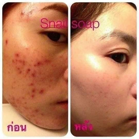 Snail White Gluta Collagen plus Soap from Thailand - My Care Kits