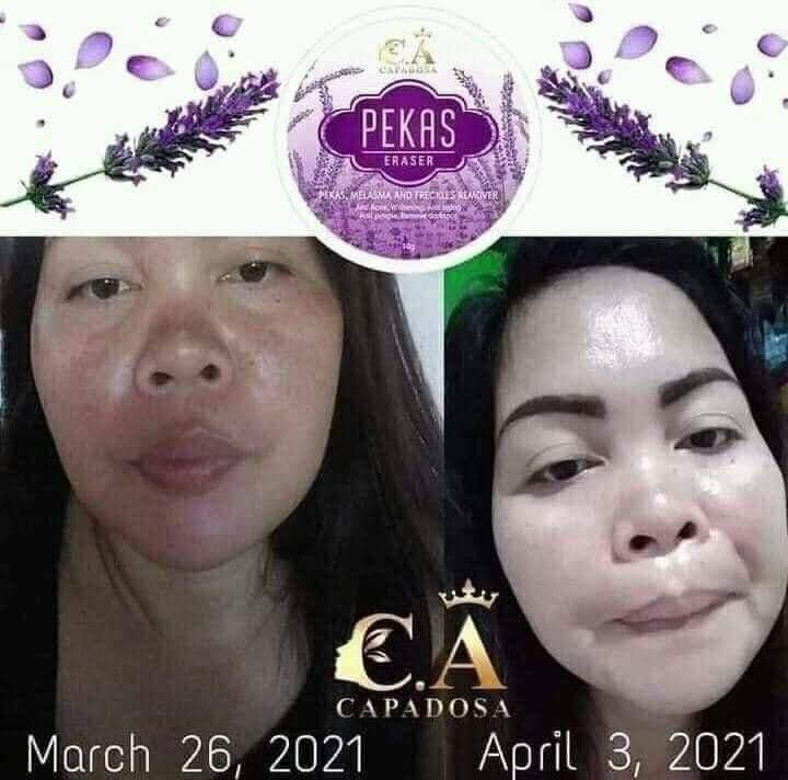 Pekas Eraser Cream 10g