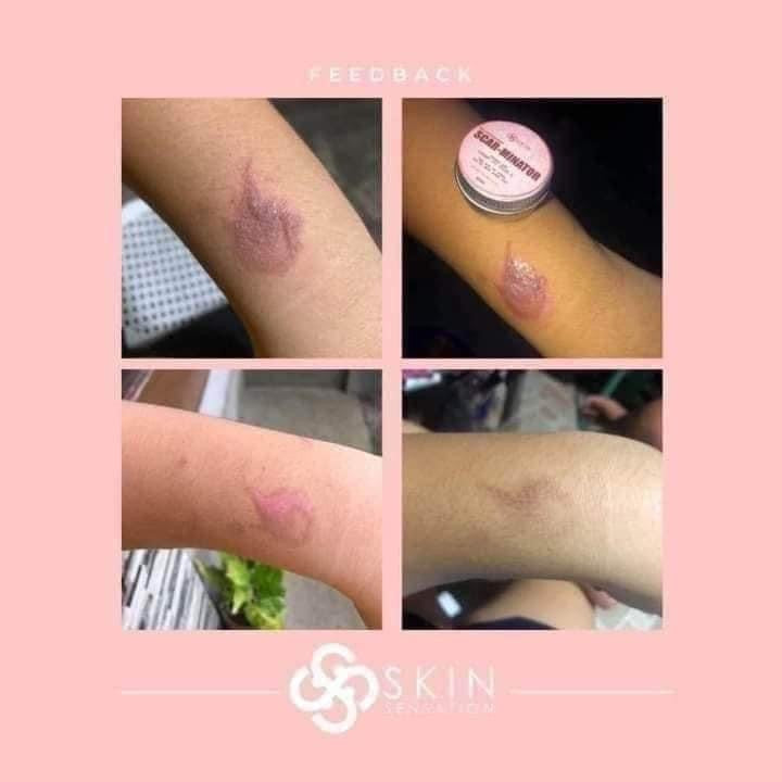 Skin Sensation - New and Improved SCAR-MINATOR 40 ml