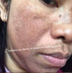 Pekas Eraser Cream 10g