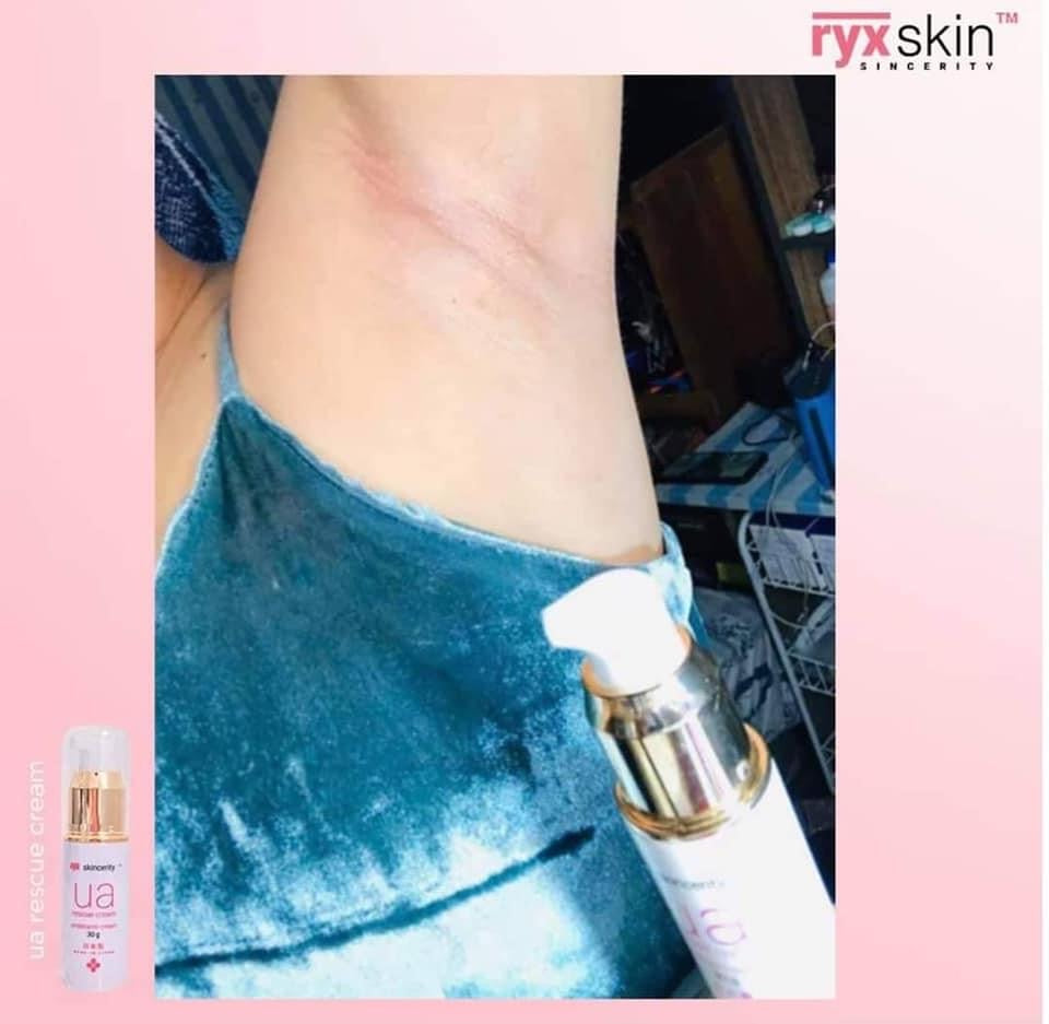 Ryx UA Rescue Cream 30g | Japan Made | Rxyskincerity underarm Cream 30g - My Care Kits